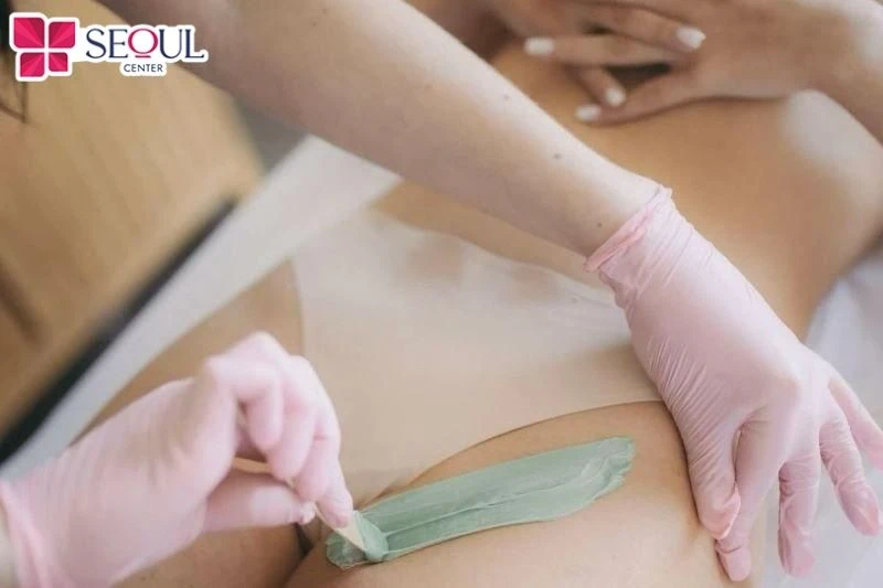 Wax lông sẽ giúp loại bỏ lông từ tận gốc nhưng phương pháp này thường gây cảm giác đau rát, đỏ nhẹ