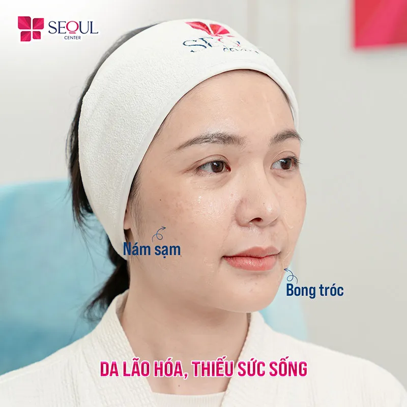 Dịch vụ này phù hợp với những ai có làn da lão hóa nhẹ, thiếu sức sống