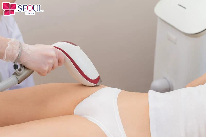 Có thể lựa chọn triệt lông vùng kín bằng công nghệ hiện đại như laser để tăng hiệu quả, tránh nguy cơ lông mọc ngược
