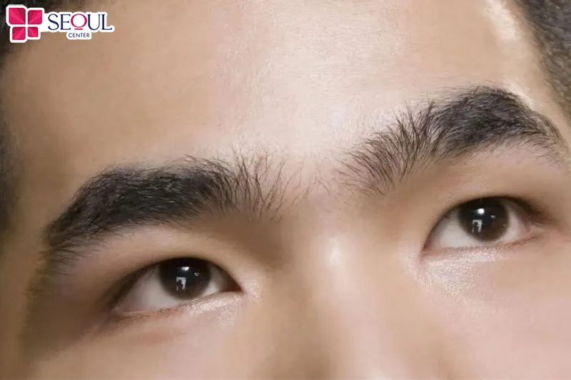 Khi giữa hai đầu lông màu quá hẹp, người này dễ gặp vất vả trong cuộc sống