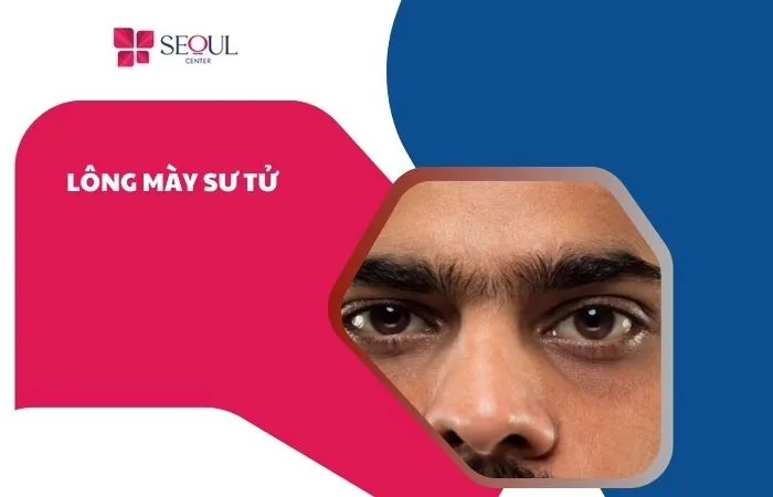 Lông mày sư tử