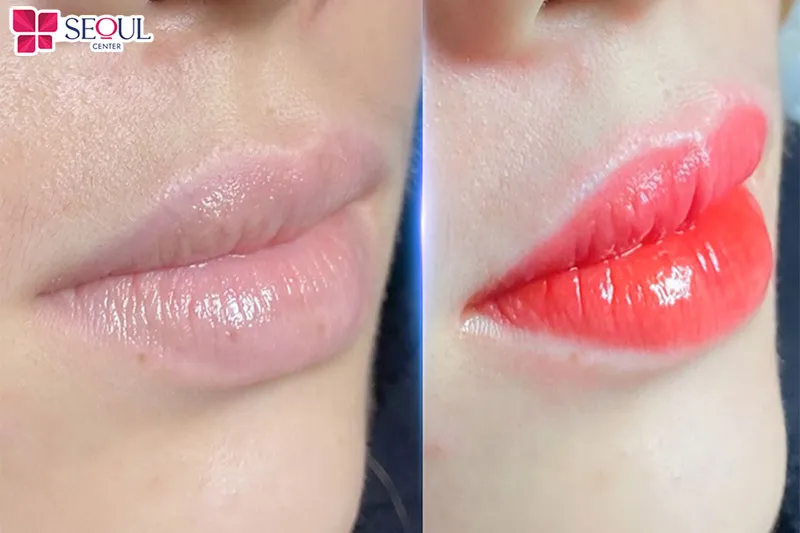 Kỹ thuật phun môi hiệu ứng pha lê đòi hỏi tay nghề chuyên môn cao của chuyên viên phun xăm