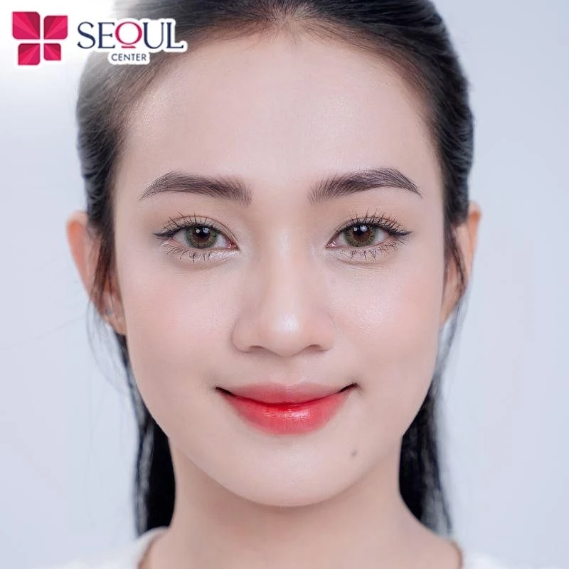 Khách hàng sau khi áp dụng công nghệ làm trắng da hiện đại tại Thẩm mỹ viện Seoul Center, làn da trở nên sáng và đều màu hơn nhiều