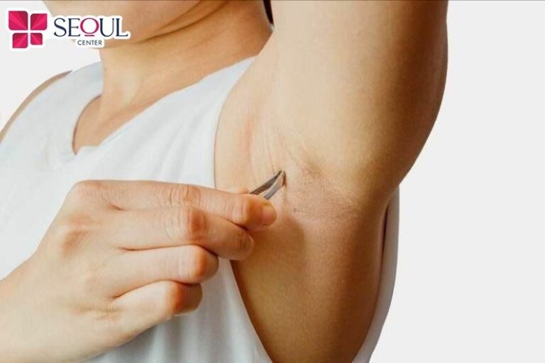 Nhổ lông sẽ giúp loại bỏ lông từ gốc nhưng nhổ liên tục hoặc thực hiện sai cách có thể làm da bị thâm