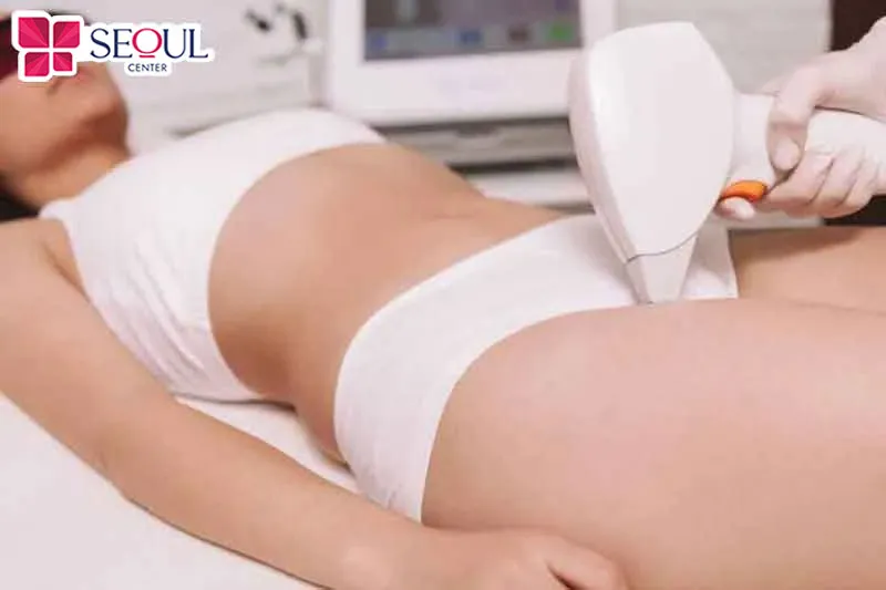 Triệt lông vùng kín cần được thực hiện bằng công nghệ hiện đại như Laser Diode tại cơ sở uy tín