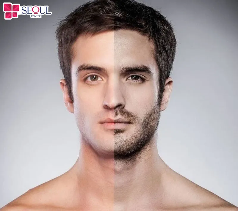 Triệt râu giúp nam giới trông gọn gàng, trẻ trung, chỉn chu và tạo ấn tượng với phái đẹp