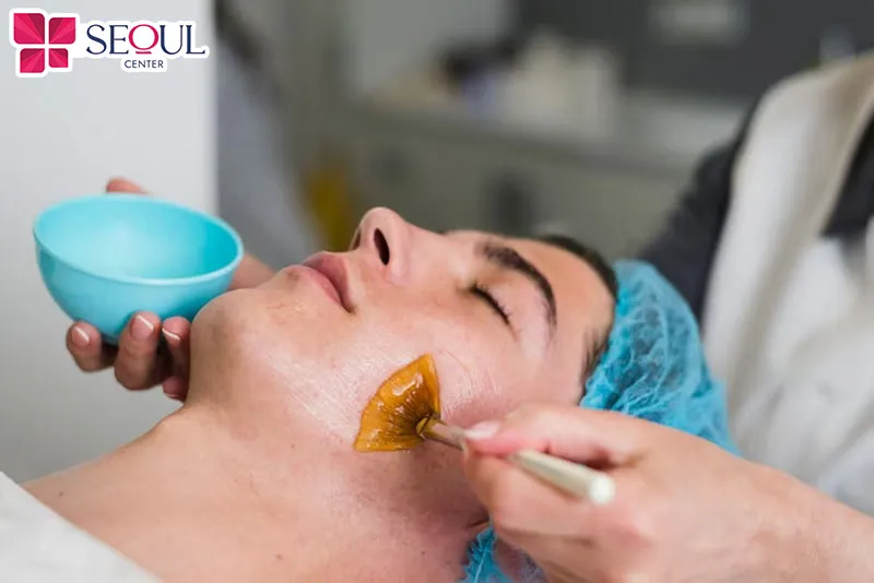Wax râu là cách gây đau nhất trong các cách triệt râu tại nhà