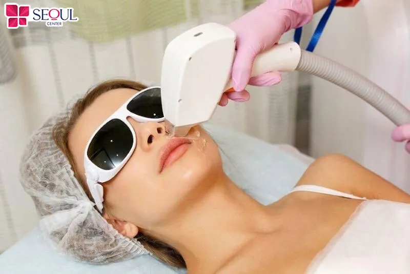 Triệt ria mép vĩnh viễn có giá dao động từ 800.000đ đến 1.000.000 đ