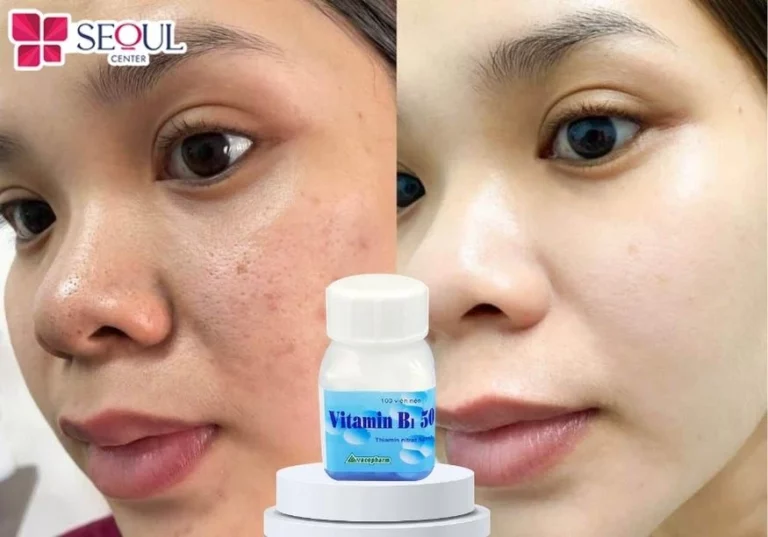 Tắm trắng bằng Vitamin B1 sẽ có hiệu quả nhưng chậm, bạn cần kiên trì áp dụng vài tháng mới thấy được dấu hiệu cải thiện