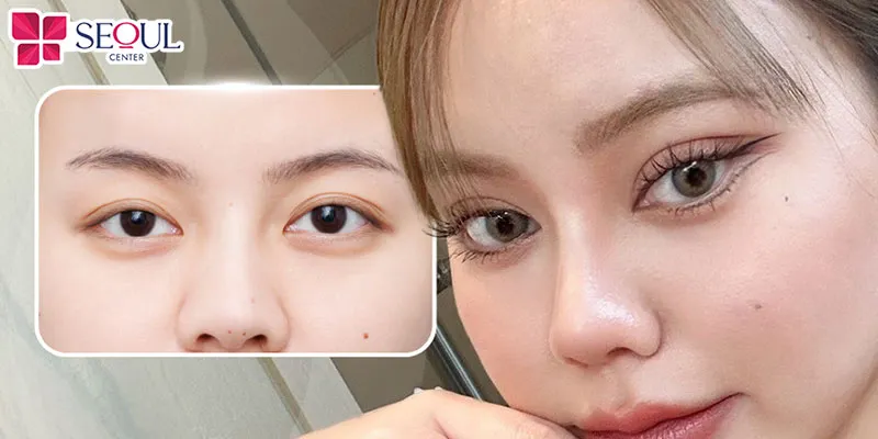 Mí phượng hoàng có phần đuôi mắt cong bay thanh thoát như đôi cánh phượng hoàng