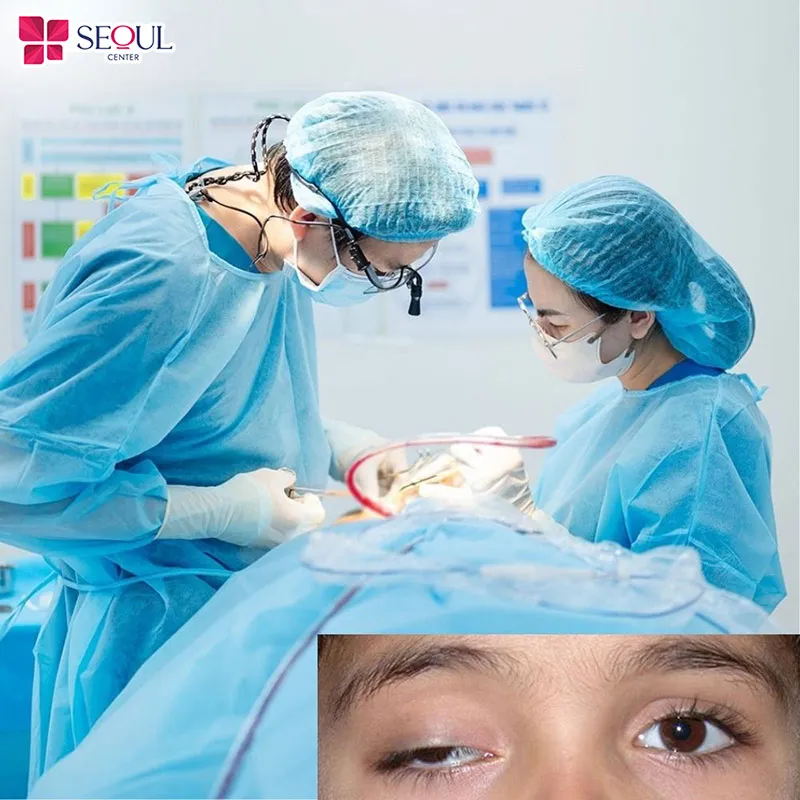 Chỉnh nhược cơ mí mắt là phương pháp cải thiện khả năng mở mắt, mang lại sự cân đối cho hai bên mắt