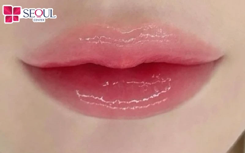 Phun môi collagen giúp môi căng mọng, khỏe khoắn từ bên trong