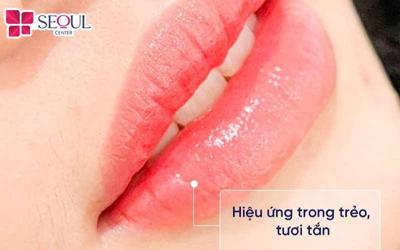 Phun môi collagen giúp môi trong trẻo, tươi tắn, duy trì hiệu quả bền lâu