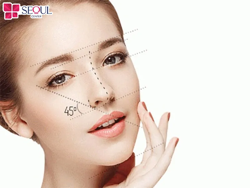 Nâng mũi bán cấu trúc Surgiform sử dụng sụn sinh học có độ tương thích sinh học cao