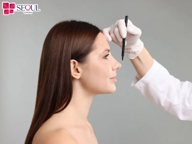 Phương pháp nâng mũi bán cấu trúc tự thân phù hợp với người có sống mũi tẹt, đầu mũi hếch lên trên