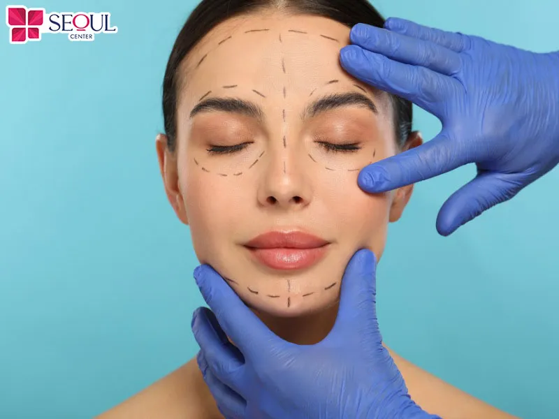 Nâng mũi bán cấu trúc sử dụng sụn tự thân Nano Mỹ đảm bảo thẩm mỹ tốt, độ bám dính cao