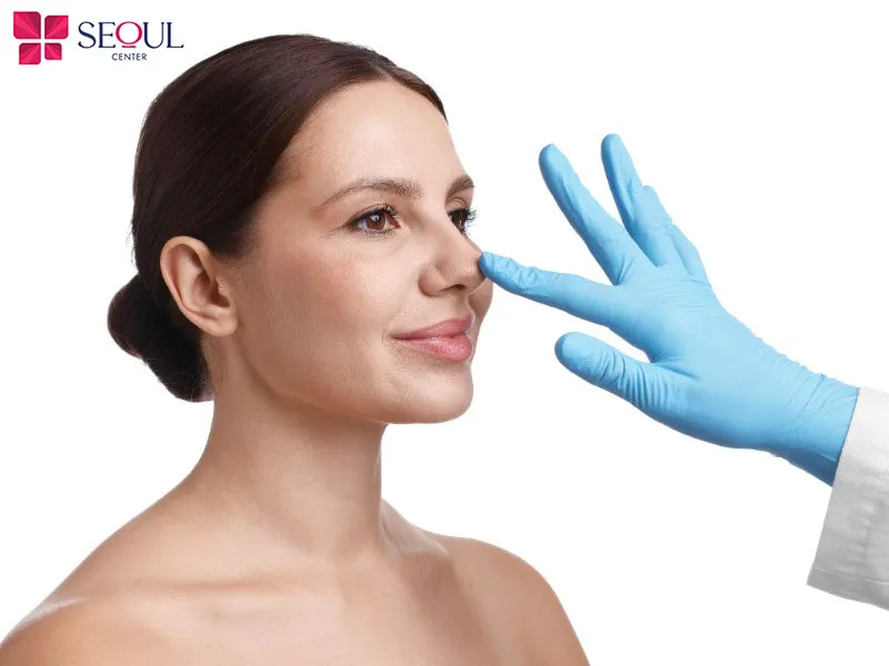 Nâng mũi cấu trúc sụn tự thân Surgiform giúp dáng mũi ổn định lâu dài