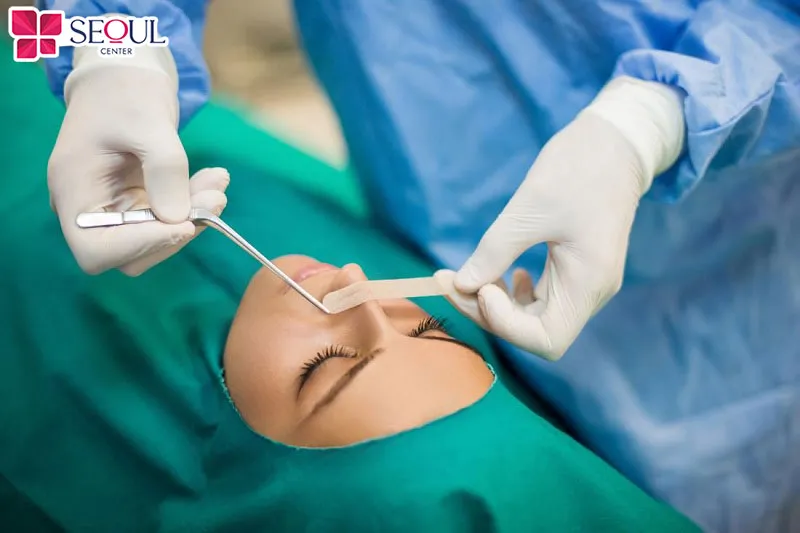 Tiến hành tháo rút sụn mũi theo các bước chuẩn y khoa