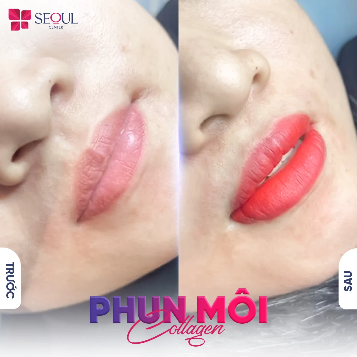 Phun môi collagen giúp môi lên màu tự nhiên, nền môi mềm mịn, ẩm mịn, tươi tắn hơn