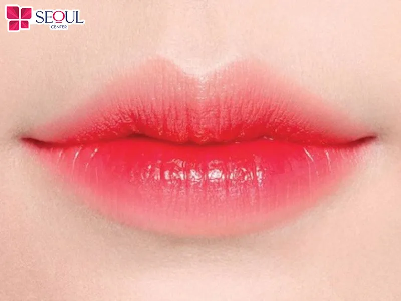 Tạo hình môi Perfect là phương pháp thẩm mỹ giúp tạo dáng môi trái tim nữ tính, cân đối