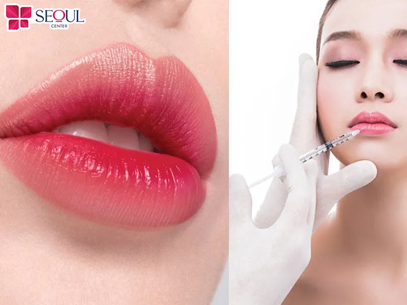 Tạo hình môi Perfect hoàn toàn không gây xâm lấn hay để lại sẹo kém thẩm mỹ