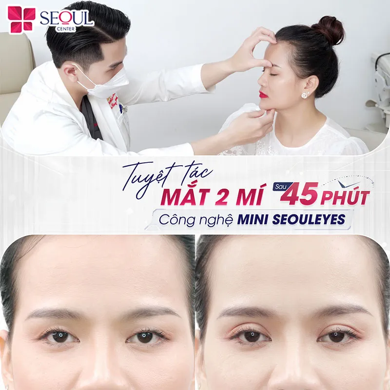 Các máy móc công nghệ phải đạt chuẩn khi thực hiện phẫu thuật cắt mí