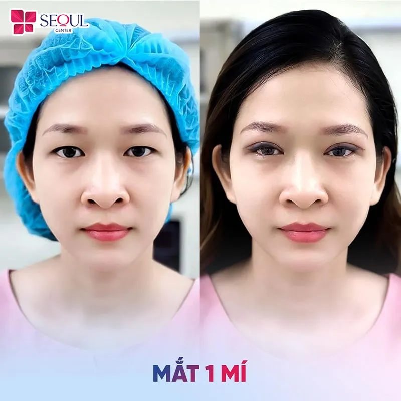 Seoul Center - nâng niu vẻ đẹp cửa sổ tâm hồn bạn