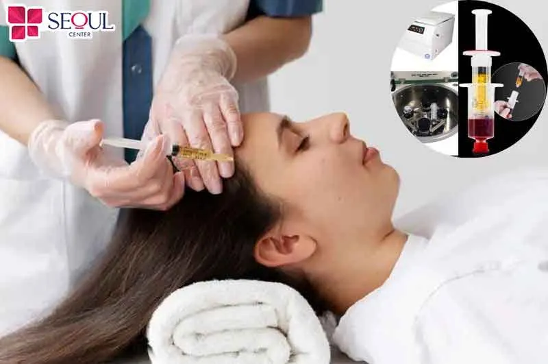 Cấy mỡ thái dương là phương pháp đưa mỡ tự thân được chiết tách từ những vùng mỡ dư thừa trên cơ thể, khắc phục vùng thái dương bị lõm hóp