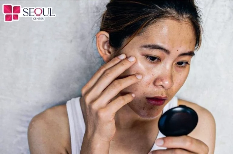 Người có làn da xỉn màu thâm sạm rất phù hợp sử dụng dịch vụ cấy trắng da mặt