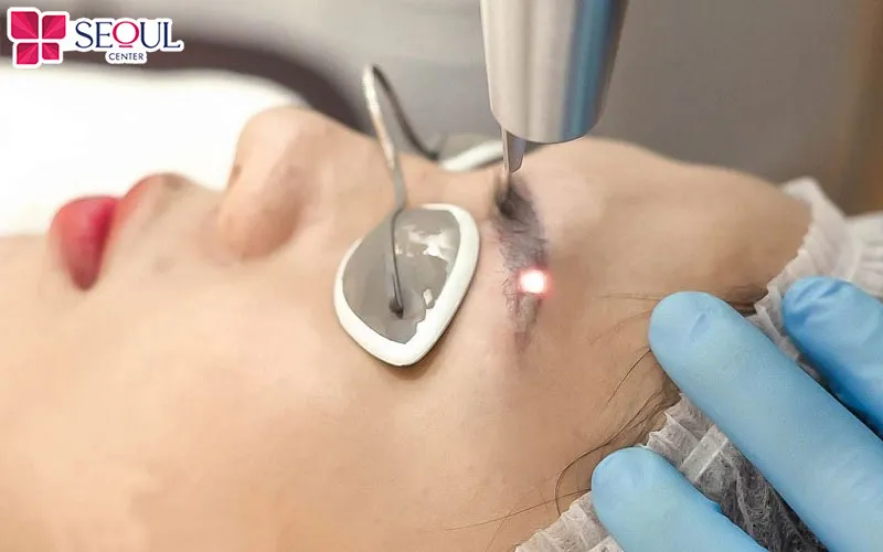 Chân mày điêu khắc hoàn toàn có thể sửa được