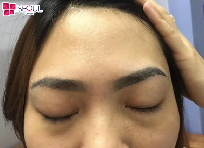 Dáng mày thô cứng, lệch lạc, sợi lông thô cứng là trường hợp nên xóa chân mày cũ để điêu khắc mới