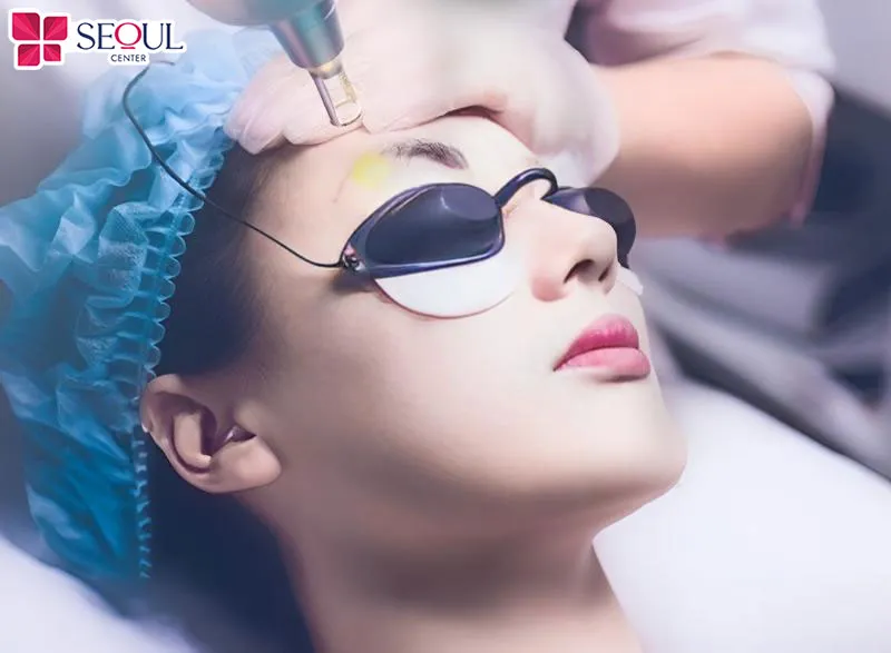 Xóa chân mày điêu khắc bằng công nghệ laser nhanh chóng, hiệu quả, an toàn