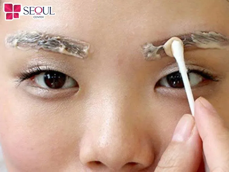 Hút mực chân mày bằng dung dịch là phương pháp sử dụng một loại dung dịch chuyên dụng để đào thải mực bên trong ra ngoài Hút mực chân mày bằng dung dịch là phương pháp sử dụng một loại dung dịch chuyên dụng để đào thải mực bên trong ra ngoài