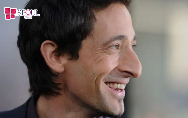 Hình ảnh người đàn ông có mũi gồ bè