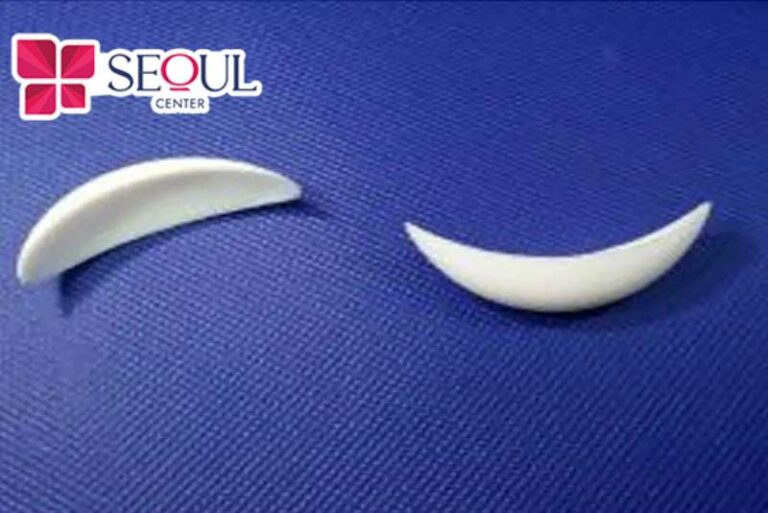 Sụn Nanoform chứa hàng triệu lỗ nhỏ li ti giúp các mô tế bào, mạch máu len lỏi, tạo nên sự liên kết với xương giúp sụn bám chắc vào