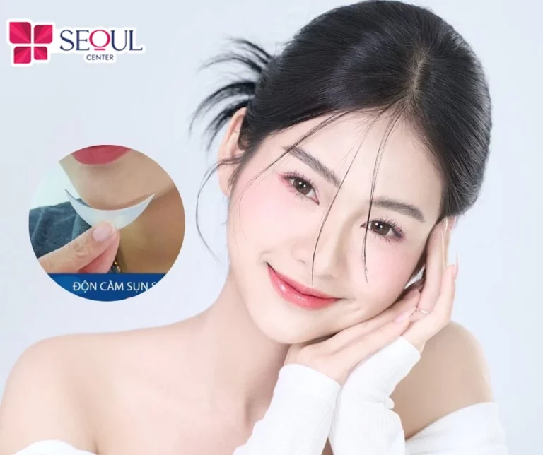 Độn cằm Surgiform là phương pháp sử dụng sụn sinh học Surgiform đưa vào cằm khắc phục dáng cằm ngắn, lẹm, tạo dáng cằm Vline cho gương mặt cân đối