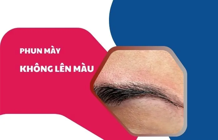Phun lông mày không lên màu