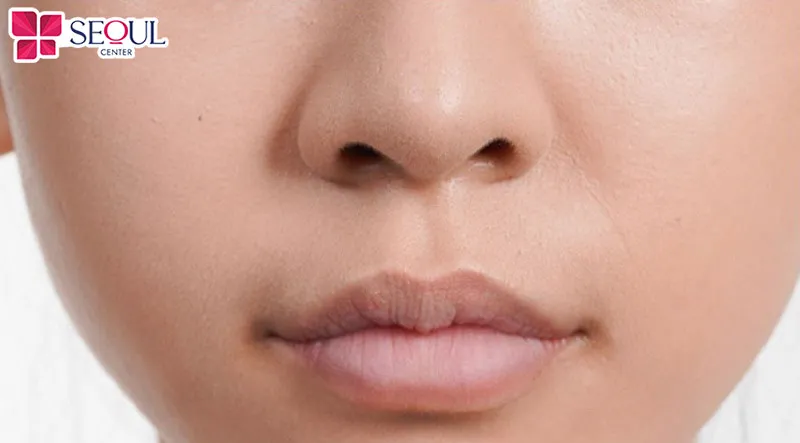 Môi thâm xỉn màu, nhợt nhạt kém sắc rất phù hợp phun môi màu đỏ cherry