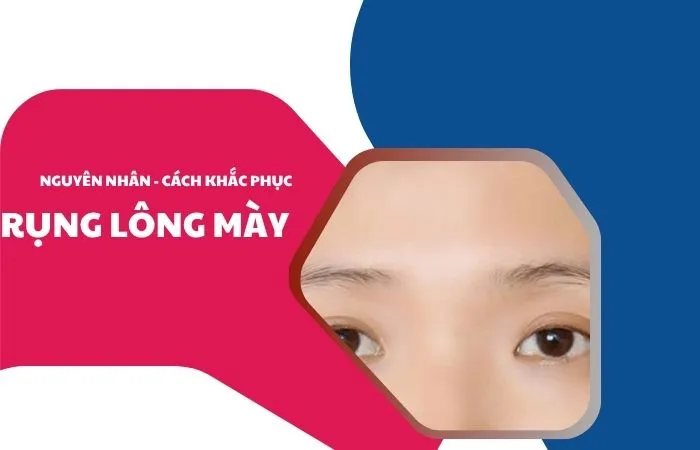 rụng lông mày