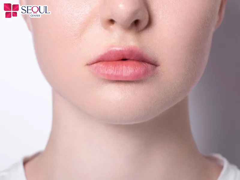 Thu mỏng môi dưới là phương pháp giúp loại bỏ phần niêm mạc môi dưới bị dư thừa
