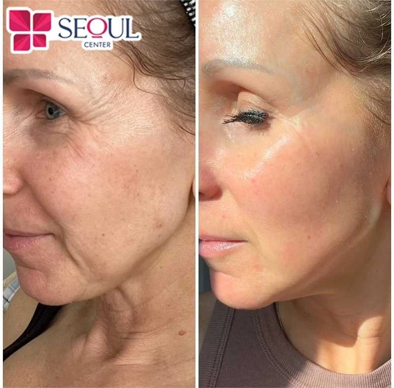 Uống collagen đúng cách sẽ giúp collagen phát huy công dụng tốt