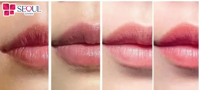 Phun môi uống nước giúp môi lên màu đẹp nhưng cần uống thời điểm sau khi môi bong vảy