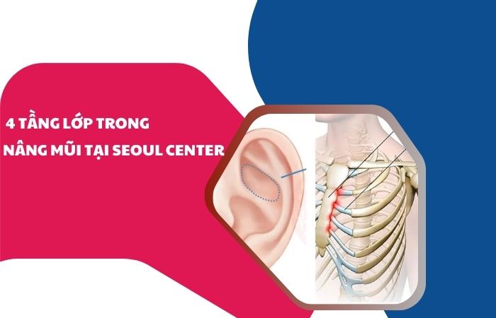 4 tầng lớp trong nâng mũi tại Seoul Center