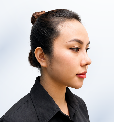 Khách hàng sau thực hiện góc nghiêng