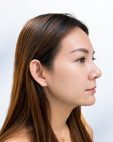 Mai An sau điều trị