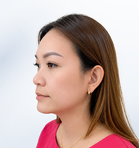 Khách hàng trước thực hiện góc nghiêng