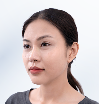 Khách hàng sau khi thực hiện thẩm mỹ