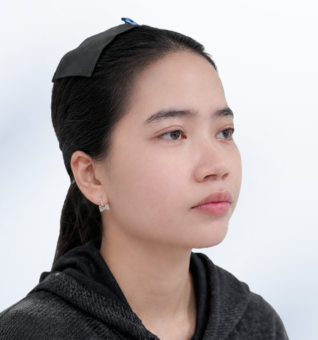 Khách hàng sau thực hiện góc nghiêng