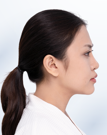 Phương Uyên trước trị liệu