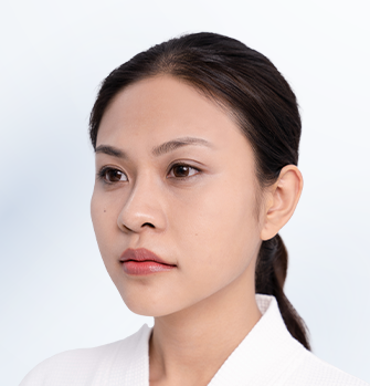 Khách hàng trước khi thực hiện thẩm mỹ